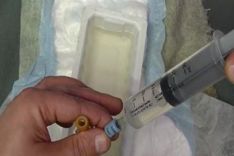 I put in A 24 French Catheter In Me. I Take In 500 ML Of Water In My Bladder. whilst My Bladder Is To The Bursting Point Play With Myself To The Point I cum whilst Having A Full Bladder. At The End I Drain My Bladder Then Remove The Catheter.